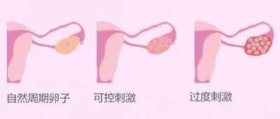 这个指标要关注，不然卵子真的会“饿死”...