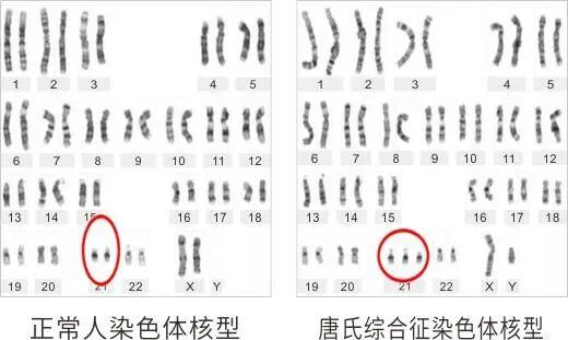 一文读懂AD、AR、XLR、XLD、Y染色体遗传分别是什么！
