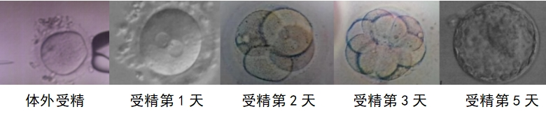 胚胎师眼中的囊胚培养原来是这样的!