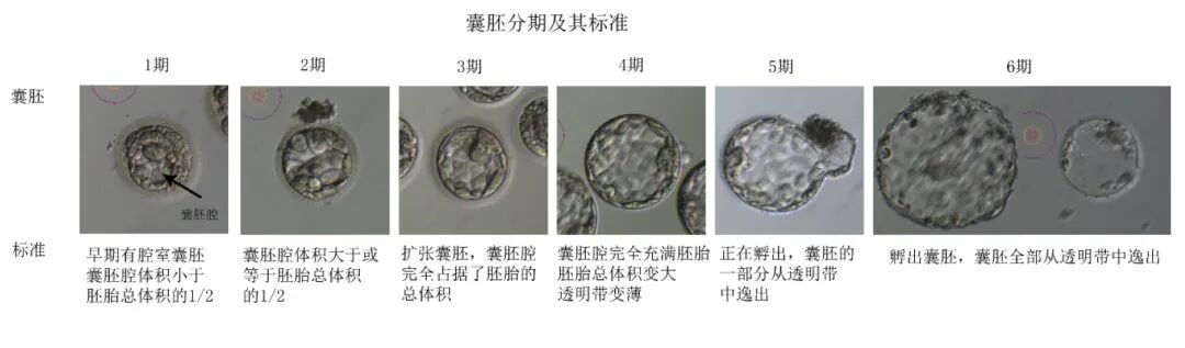 胚胎评分高≠移植成功,这些真相一定了解!