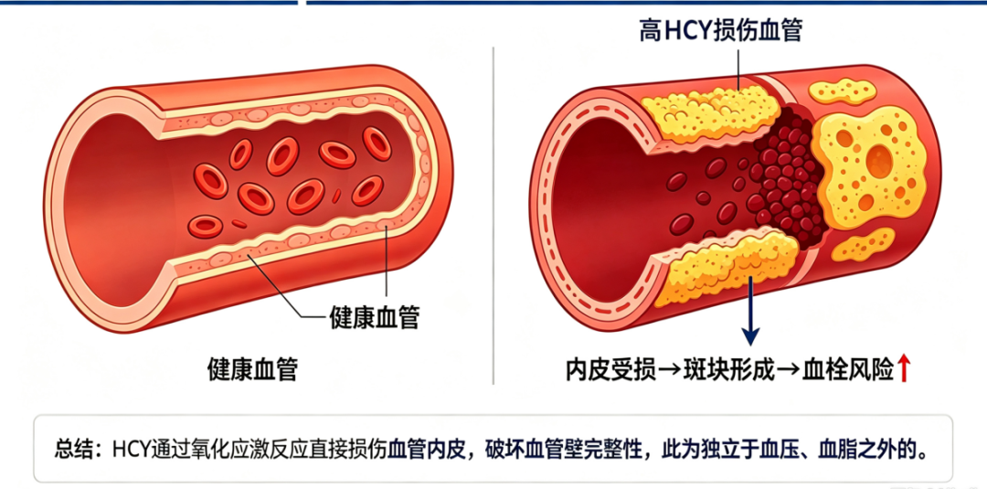 同型半胱氨酸,藏着甲状腺健康信号!